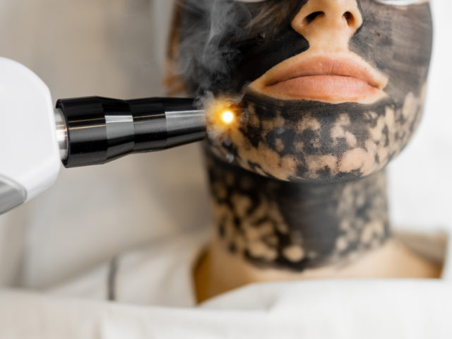 Le Carbon Peel: un soin éclat et pureté pour votre peau