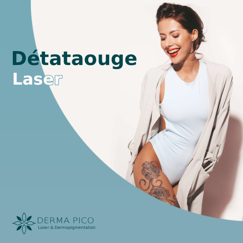 detatouage laser