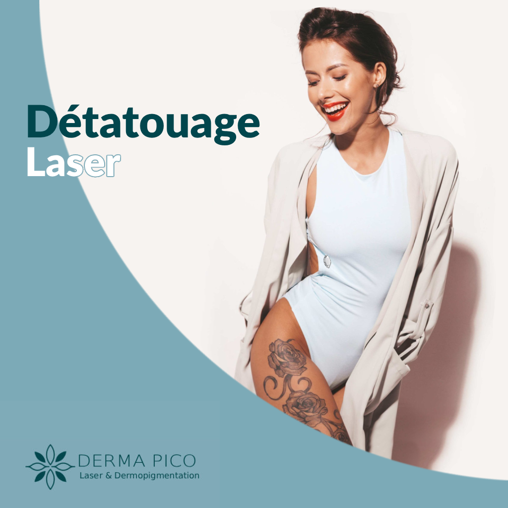 Détatouage Laser